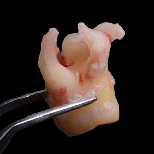 Story 3 Picture 1 Alt Text