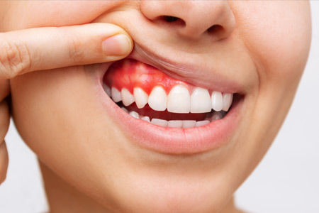 Story 1 Picture 2 Alt Text