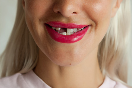 Story 1 Picture 3 Alt Text